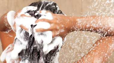 Aloe Vera Gel to Help Dandruff and Baldness