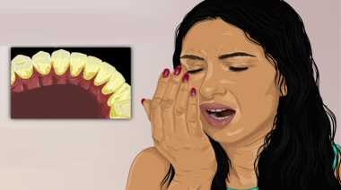 Aloe Vera Gel for Bad Breath